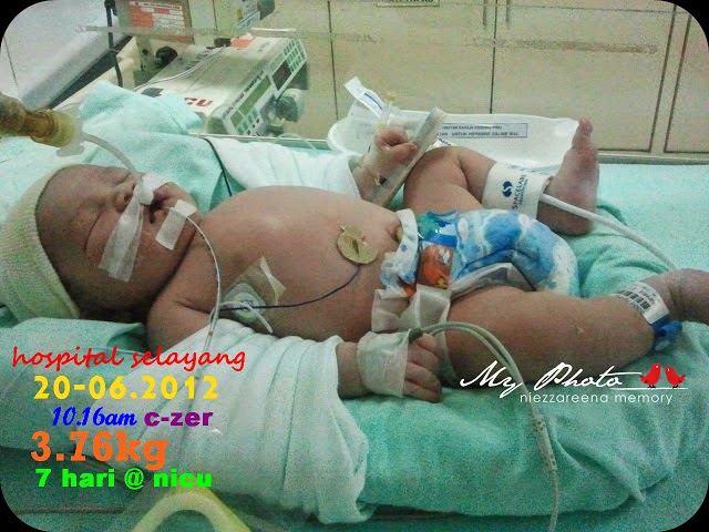 Qausar hari pertama @ NICU