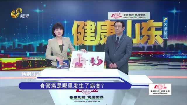 20240330ã€Šå¥åº·å±±ä¸œã€‹ï¼šé£Ÿç®¡ç™Œæ˜¯å“ªé‡Œå‘ç”Ÿäº†ç—…å˜ï¼Ÿ