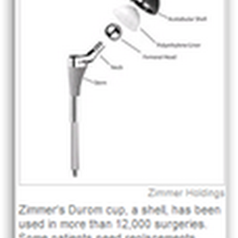 Complaints Undermine Hip Device – Zimmer Hip