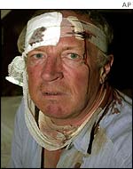 Bandaged and bleeding Robert Fisk