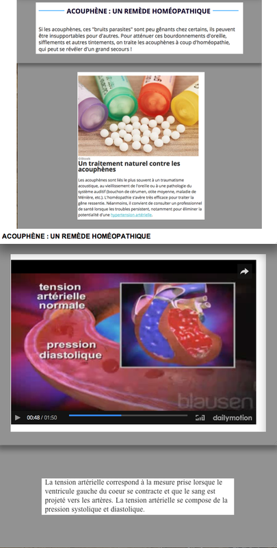 L'HYPERACOUSIE ET LES ACOUPHÈNES ART 677