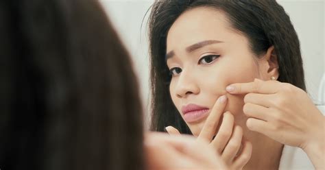 The Best Way To Pop A Pimple Safely, According To Dermatologists | HuffPost