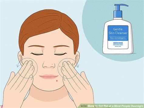 4 Ways to Get Rid of a Blind Pimple Overnight - wikiHow