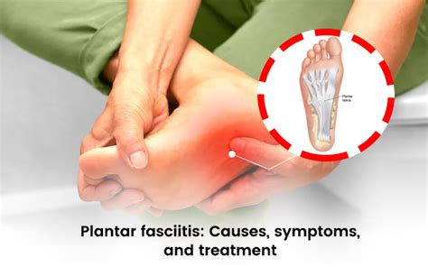 Plantar Fasciitis: Causes, Symptoms, and Treatment - The Newtown Clinic