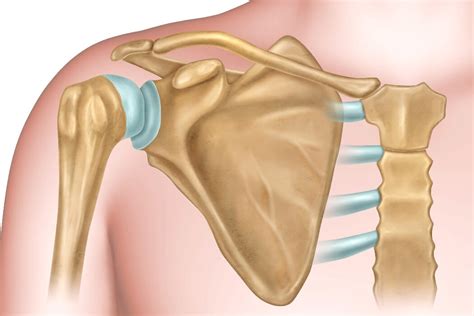 Shoulder Dislocation