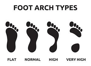 Foot Arch Types: What You Need To Know | FootGearLab