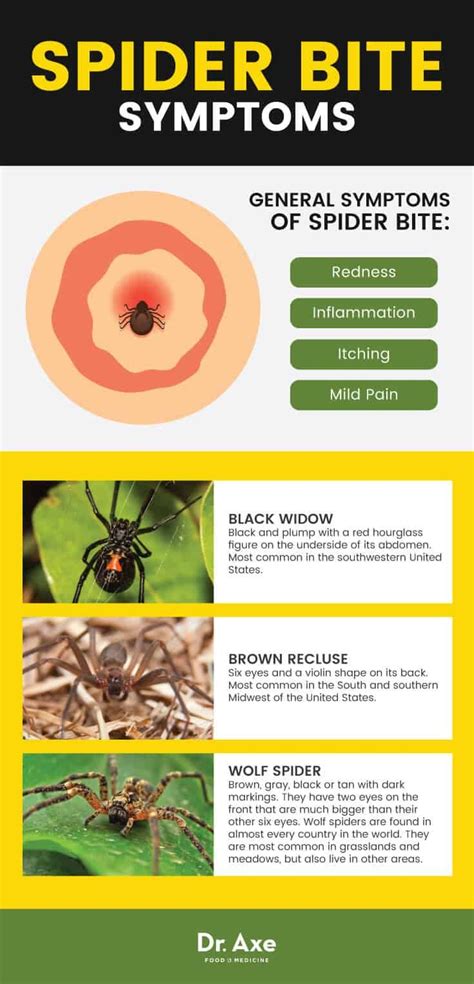 House Spider Bite Identification Chart