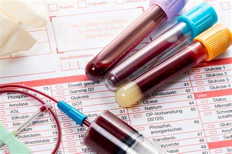 Blood test, blood samples on a laboratory form - TrueTest Labs