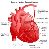 General Surgery - Common Surgical Procedures | Stanford Health Care