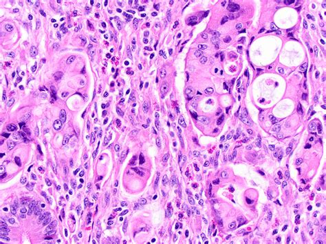 Pancreatic Duct Histology