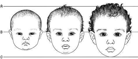 6.1.R1 Basic Facial Proportions: Infant to Adult - Drawspace