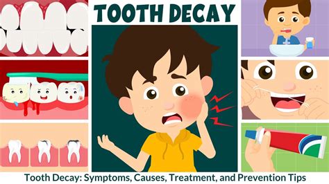 Tooth Decay Prevention