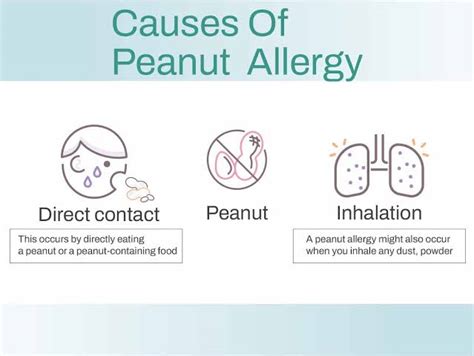 Peanut Allergy - Symptoms, Causes & Treatment - Santripty