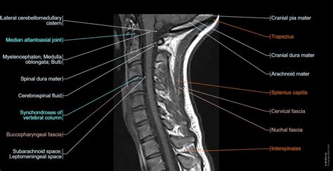 Cervical spine MRI: normal anatomy | e-Anatomy