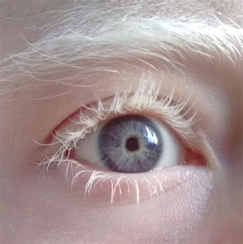 Albino Love | Aesthetic eyes, Pretty eyes, Eye art