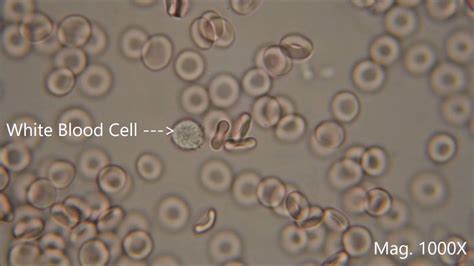 Human Blood Cell Under Microscope