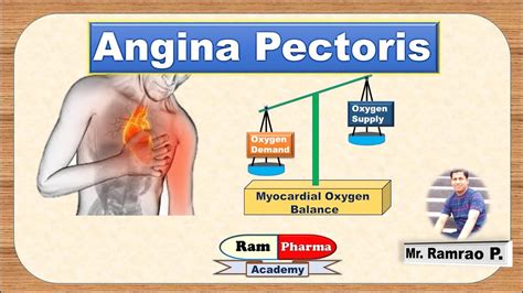 Welche Symptome Bei Angina Pectoris - Image to u