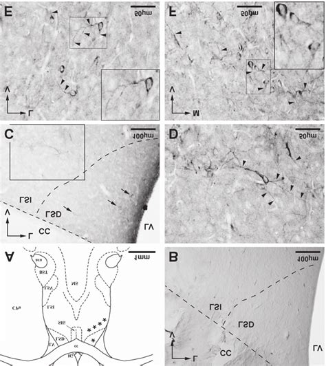 A) Frontal section (Bregma 0.2 mm) of the rat telencephalon ...