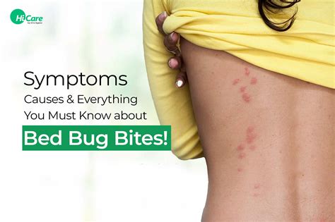 Bed Bug Bites Symptoms Time