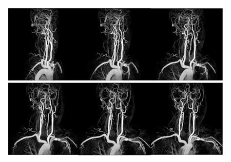 MRI/MRA | Southern California | Centrelake Imaging