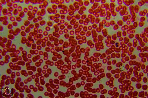 Under the Microscope: Red Blood Cells › Travis Hale (Photography and ...