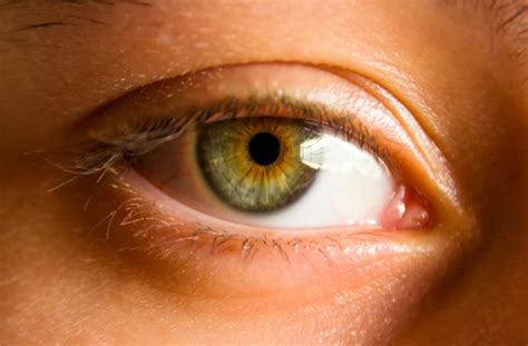 Hazel eye colour facts | What are hazel eyes? - All About Vision