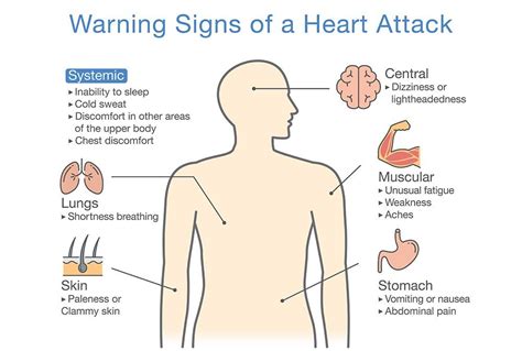 Coronary Artery Disease Symptoms