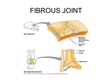 Pin on Chapter 9 - Joints