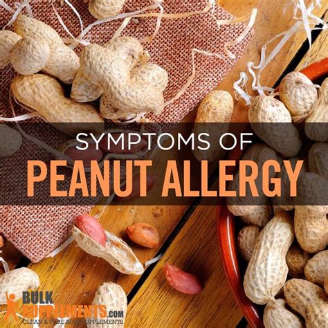 Peanut Allergy: Symptoms, Causes & Treatment