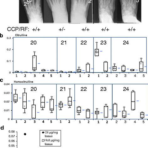 RA synovial tissue histology. a H&E, (b) citrulline and homocitrulline ...