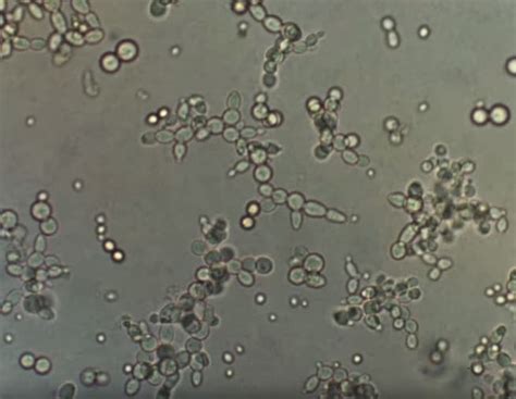 Yeast Under a Microscope – Microscope Clarity