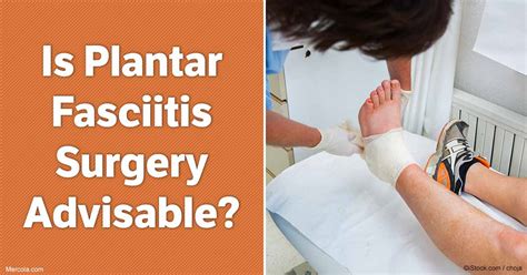 Is Plantar Fasciitis Surgery Advisable?