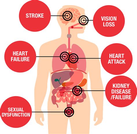 What is High Blood Pressure? | American Heart Association