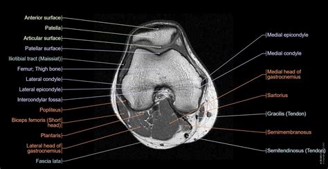 Knee Anatomy Mri