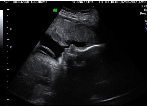 The Whaleys: 31 Week Ultrasound