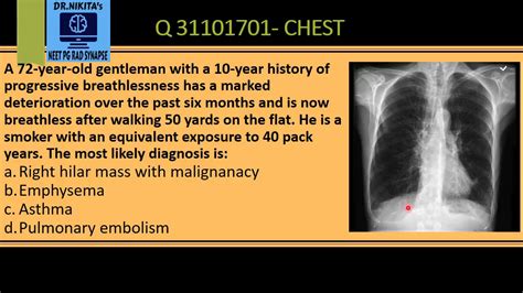 Copd Lung Chest X Ray