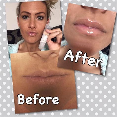 Amazing before and after photos of our contouring lip gloss. Use twice ...