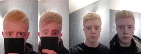 Albino Hair Progress : r/malehairadvice