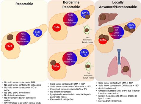 Pancreatic cancer resectability diagram. The surgical resectability of ...