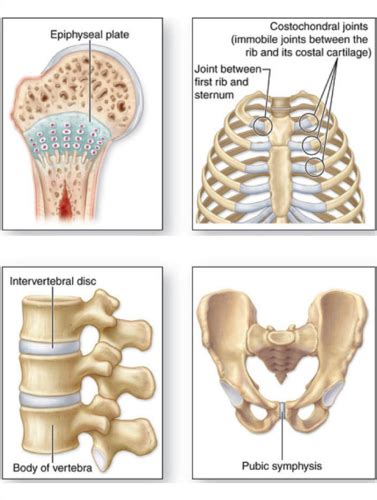 Chapter 9: Joints to slide 26 Flashcards | Quizlet