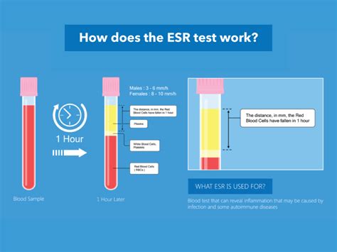 The ESR Result Decoded: Your Health Status Revealed