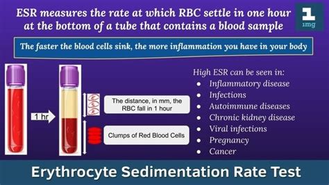 ESR Blood Tests - Dublin Health Screening