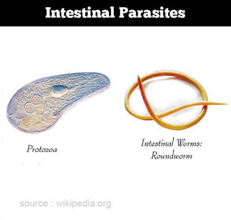 Intestinal Parasite Infection - Types, Causes, Symptoms, Diagnosis ...