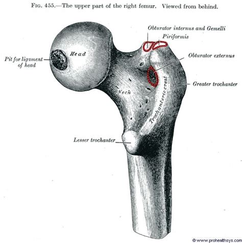 Femur - Prohealthsys