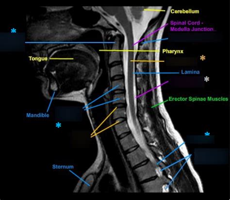 C Spine Anatomy |MRI Cervical Spine Sagittal Anatomy, 44% OFF