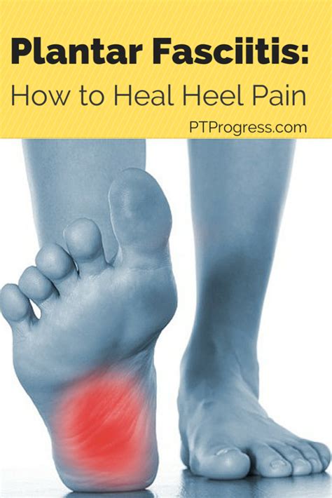 Plantar Fasciitis Treatment: How to Heal Heel Pain