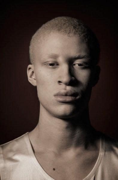 Albino Male Model Shaun Ross | Albino model, Albino men, Shaun ross