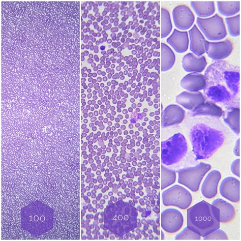 Red Blood Cell Microscope 100x