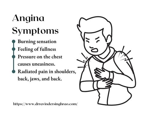 Angina: Symptoms, Causes Treatment, 49% OFF | rbk.bm