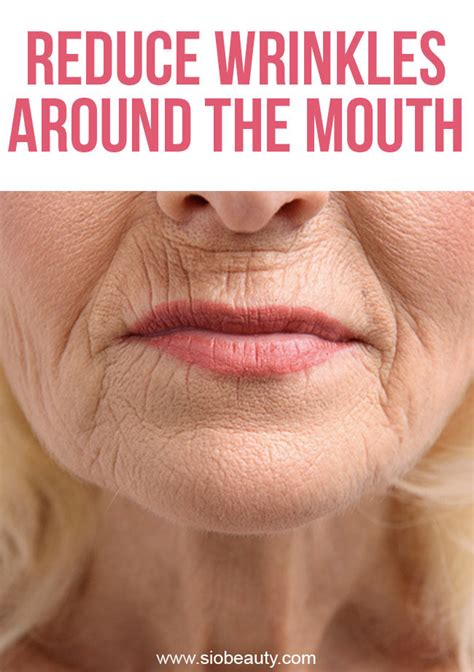 How To Treat Wrinkles Around The Mouth